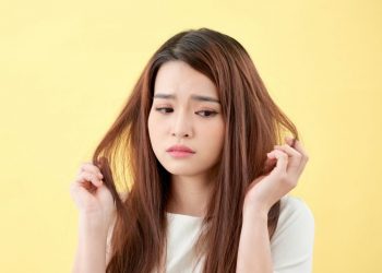 atasi ketombe - erhastory - 750x