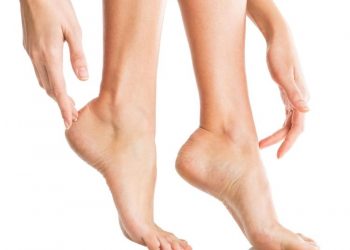 tumit, atasi tumit pecah-pecah, kaki pecah-pecah