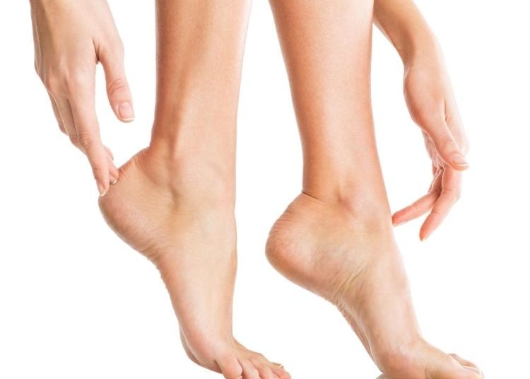 tumit, atasi tumit pecah-pecah, kaki pecah-pecah