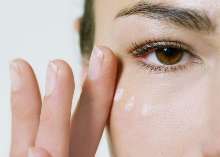 Catat! 5 Cara Menghilangkan Mata Panda dan Kantung Mata