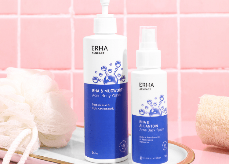 jerawat, jerawat punggung, cara mengatasi jerawat