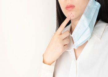 Apa itu Maskne? Ini Dia 3 Cara Mudah Mengatasi Maskne yang Wajib Kamu Tau!