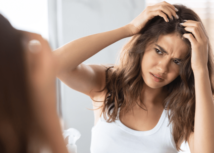 Kulit Kepala Kering dan Berketombe? Ini 5 Tips Ampuh buat Kamu!