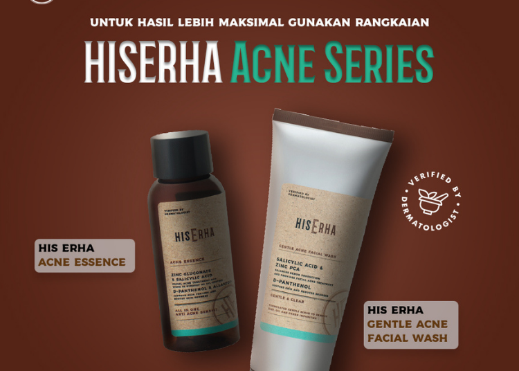 Ini Dia Rahasia Skincare Ampuh Untuk Menghilangkan Jerawat Pada Pria