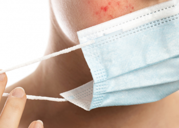 Rekomendasi Produk Jitu Untuk Mengatasi Maskne, Lihat Perubahannya Dalam 7 Hari!