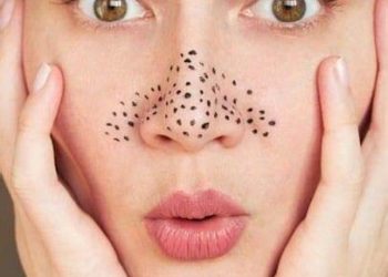 Rahasia Mengecilkan Pori-Pori di 2022!