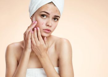 moisturizer untuk kulit berjerawat