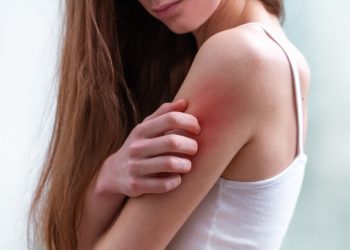 Sabun untuk Kulit Sensitif