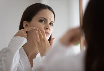 Jerawat Meradang? Simak 4 Tips Mengatasi Jerawat yang Ampuh ala ERHA!