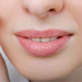 bibir kering