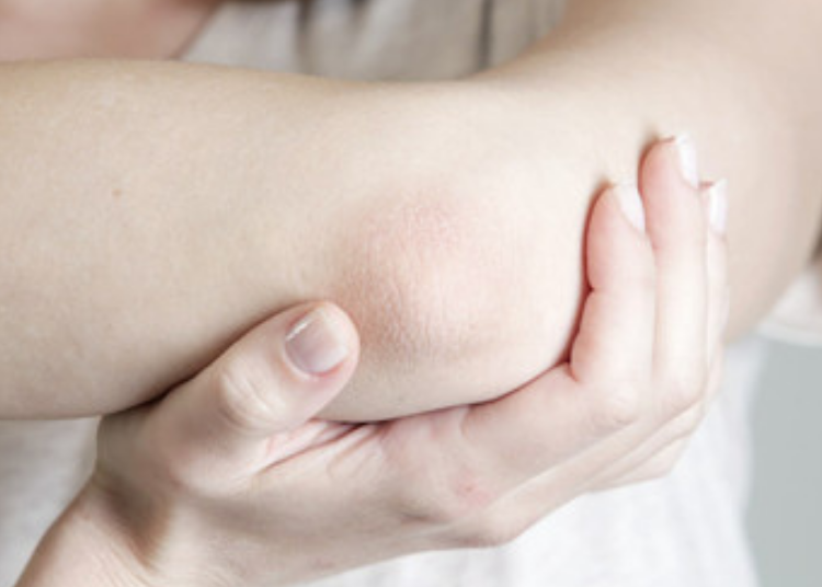 cara merawat kulit kering