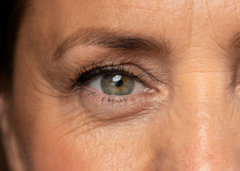 4 Penyebab Kemunculan Kerutan Garis Mata dan Produk Ampuh Mengatasinya