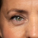4 Penyebab Kemunculan Kerutan Garis Mata dan Produk Ampuh Mengatasinya
