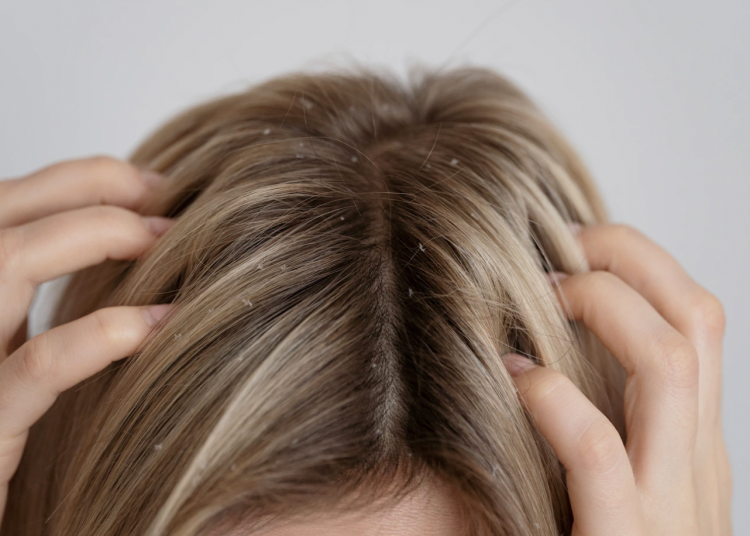 scalp