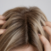 scalp