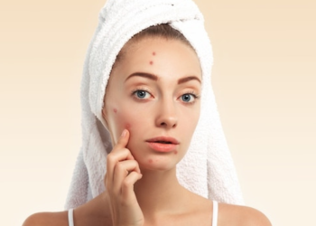 Orang yang memiliki tipe jerawat