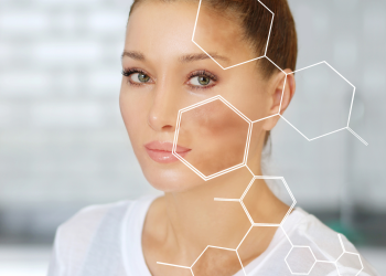 wanita dengan flek hitam