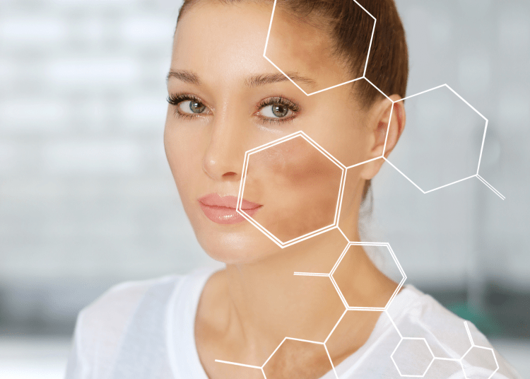 wanita dengan flek hitam