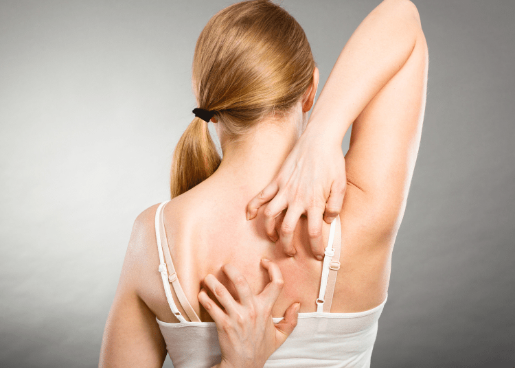 perawatan jerawat badan