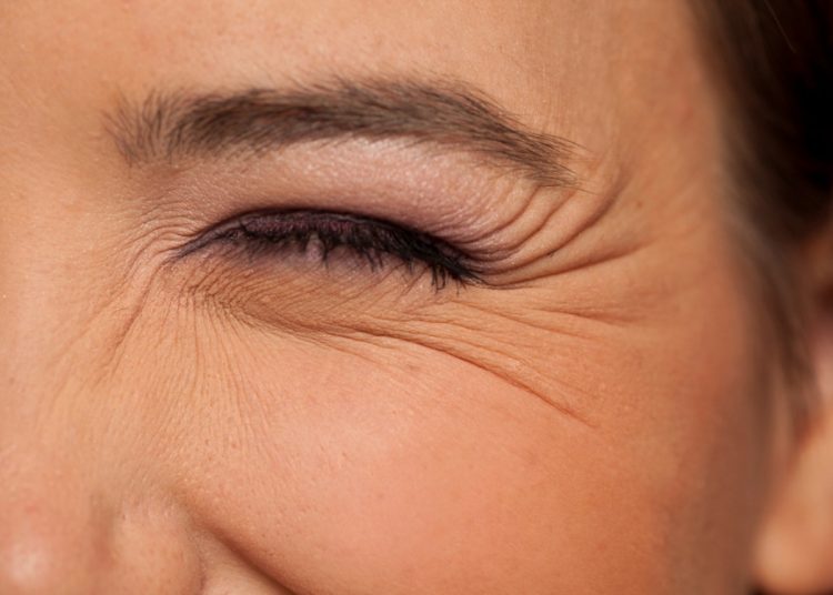 mengatasi wajah keriput