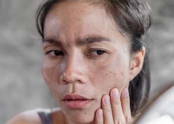 cara mengatasi kulit kusam