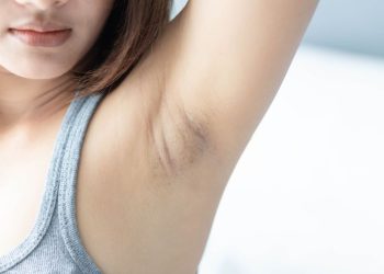 menghilangkan ketiak gelap