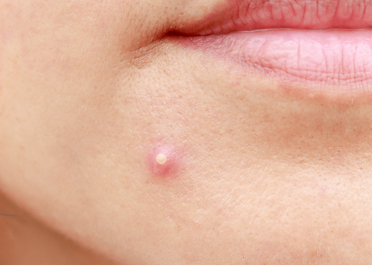 Gak Bikin Wajah Ketarik, Ini Facial Wash yang Cocok untuk Kulit