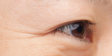Serum Anti-Aging