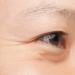 Serum Anti-Aging