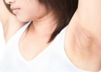 3 Cara Memutihkan Ketiak, Sudah Coba Belum?