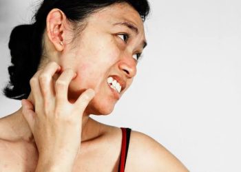 Gatal Kemerahan pada Kulit? Jangan Panik, Ini Dia 3 Solusinya!