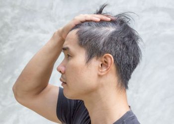 Rambut Rontok Pada Pria bisa menyebabkan kebotakan! Ini 3 Cara Merawat Rambut Pria yang Perlu Dilakukan!