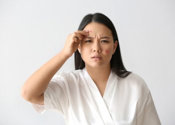 Sunscreen Khusus Kulit Berjerawat