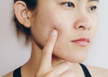 Wow! 2 Serum ini bisa Atasi Kulit Kering Berjerawat!