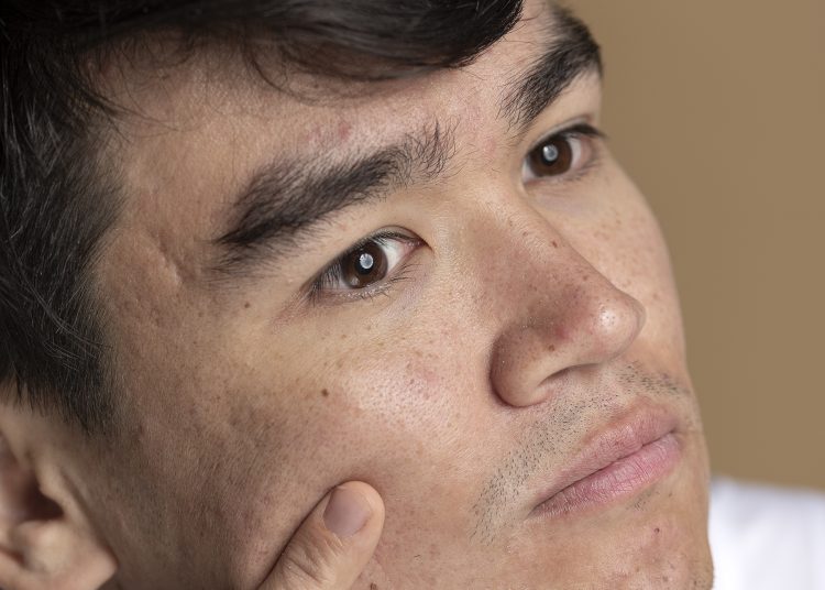 kulit kusam mengganggu