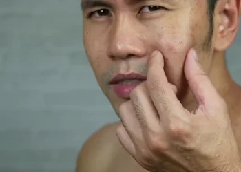 Kata Siapa Pria dengan Kulit Berjerawat Gak Boleh Pakai Skincare? Coba 1 Bundle Ini Khusus Pria yang Recommended Banget!