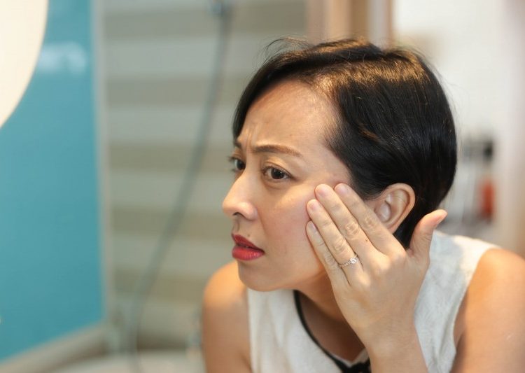 Cara menghilangkan kerutan di wajah