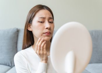 Hempaskan Jerawat Membandel dalam 24 Jam dengan Ingredients BHA dan Sulfur!