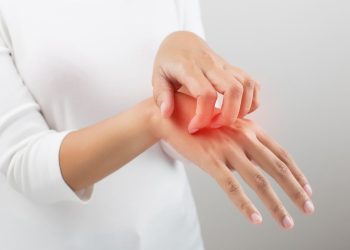 Natal Sebentar Lagi, Waktunya Kamu Rawat Kulit Secara Extra dengan 1 Krim Ajaib Ini Agar Eksim Tidak Kambuh!