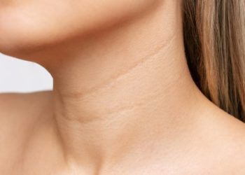 Mumpung Promo 12.12 Saatnya Bebas dari Leher Berkerut dengan Belanja Age Corrector Firming Neck Cream dan Join Jadi #GankLeherMoist!