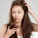 Hair Loss