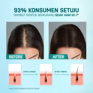 Kopexil