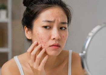 Traveling Bikin Kulit Mudah Breakout? Ini yang Perlu Diperhatikan!