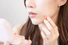 Jerawat Baru Muncul Siang Hari, Apa yang Sebaiknya Dilakukan Malam Ini?