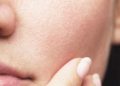 Kulit Sudah Pakai Moisturizer, Tapi Kok Masih Terasa Kering?