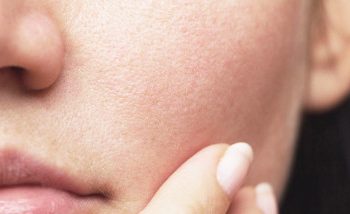 Kulit Sudah Pakai Moisturizer, Tapi Kok Masih Terasa Kering?