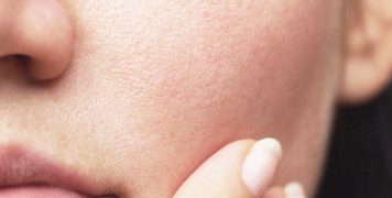 Kulit Sudah Pakai Moisturizer, Tapi Kok Masih Terasa Kering?