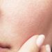 Kulit Sudah Pakai Moisturizer, Tapi Kok Masih Terasa Kering?