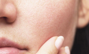 Kulit Sudah Pakai Moisturizer, Tapi Kok Masih Terasa Kering?