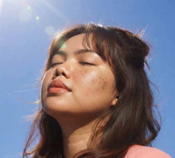 Sering Aktivitas di Luar Ruangan? Ini Alasan Dark Spot Bisa Makin Susah Diatasi!